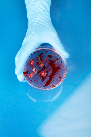 Hand in blue glove holding petri dish with bacterium. Microbiology science. Top view.
