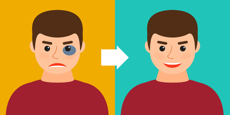 young man with a bruise or without. Before and after. Vector illustration. Recovery, healing, regeneration.のイラスト素材