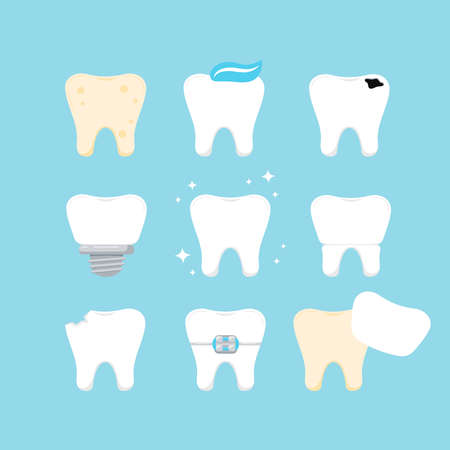 Teeth dental icon set isolated. Tooth collection - plaque, caries hole, implant, clean healthy, crown, chipped, in braces and veneer. Vector flat design cartoon style tooth illustration.のイラスト素材