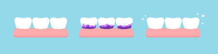 White tooth and with yellow tartar plaque before after plaque test icon set.のイラスト素材