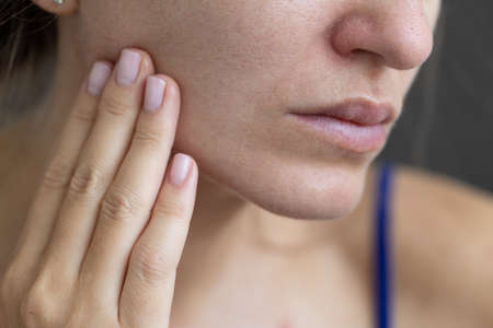 Young woman with a problem dry skin and with big pores.の写真素材