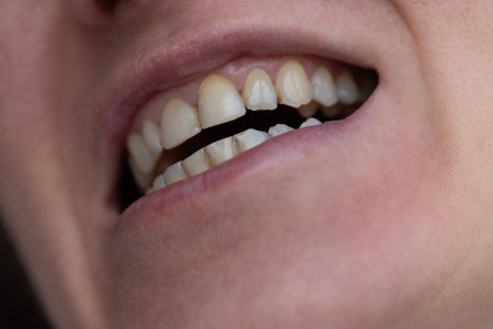 Woman showing teeth with dental calculus and plaque. Closeup. Dental care concept.の写真素材