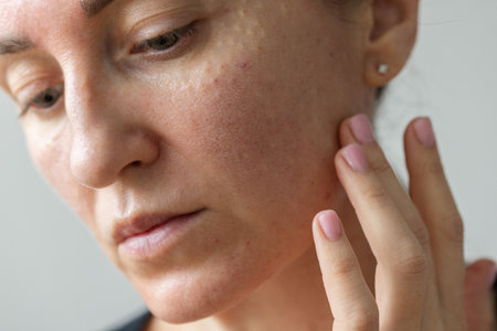 Womans face after beauty injections. Cosmetology procedures.の写真素材