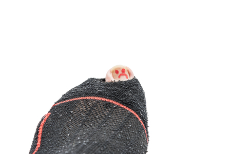 A close up of a sad smily painted toe nail lurking out of a torned sock.の写真素材