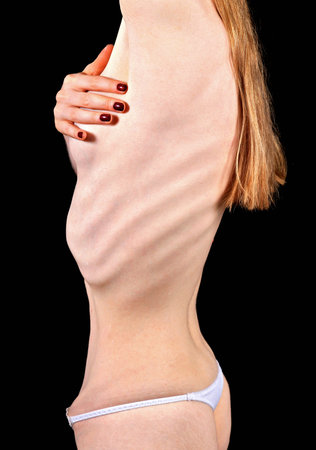 Part of woman body suffering anorexia nervosaの写真素材