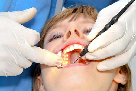 Girl at dental office during teeth exam の写真素材