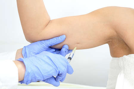 Woman Having Under Arm Injection at Beauty Clinicの写真素材