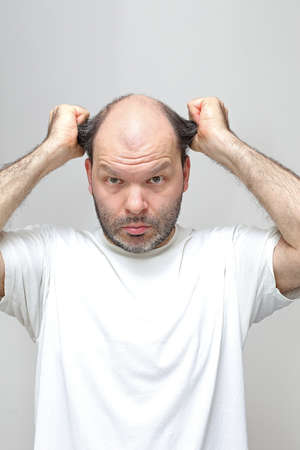 Middle Age Man Pulling Hair Baldness Problemの写真素材