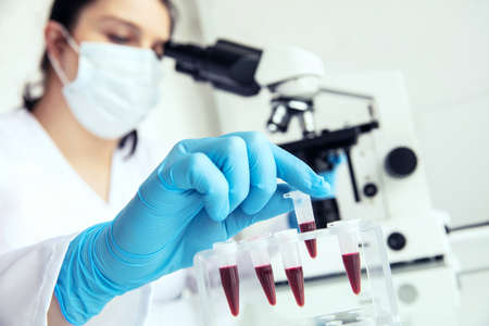 Hand in medical gloves takes eppendorf with blood. Female medician takes eppendorf test-tube with human blood to examine and microscope in the background.の写真素材