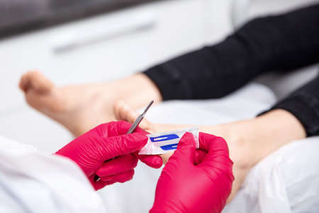 Chiropodists unpacks a scalpel blade from the sterile packaging