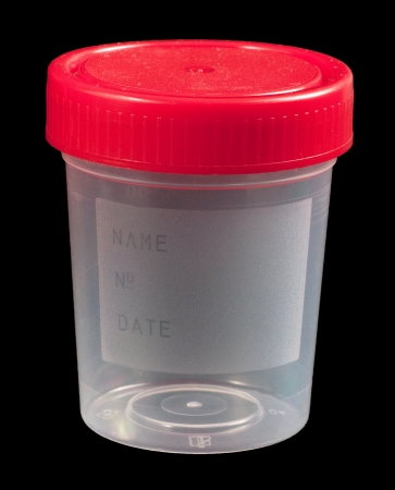 Empty urine sample container isolated on blackの写真素材