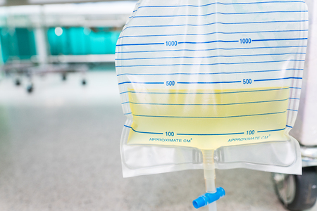 Urine bag hanging beside the patient's bed. Inside the hospital room.