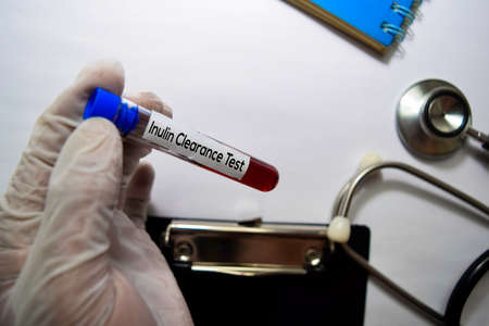 Inulin Clearance - Test text on top view isolated on white background. Healthcare/Medical concept