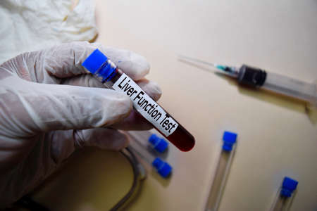 Liver Function Test text on Sticky Notes. Top view isolated on office desk. Healthcare/Medical...