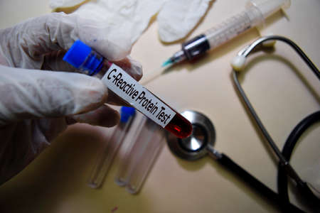 C-Reactive Protein Test text on Sticky Notes. Top view isolated on office desk. Healthcare/Medical...