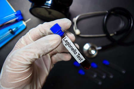 Legionella Test text with blood sample. Top view isolated on black background. Healthcare/Medical conceptの写真素材