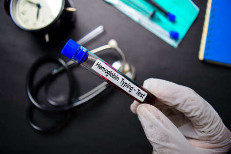 Hermoglobin Typing - Test with blood sample. Top view isolated on black background. Healthcare/Medical conceptの写真素材