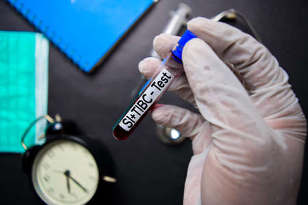 SI+TIBC - Test with blood sample. Top view isolated on black background. Healthcare/Medical conceptの写真素材