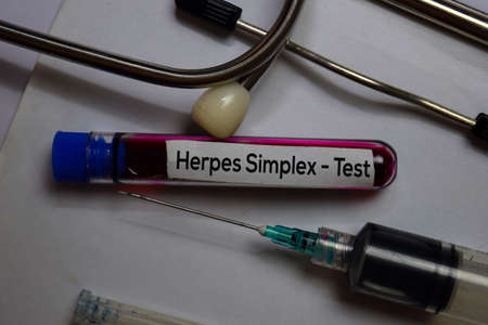 Herpes Simplex - Test with blood sample. Top view isolated on office desk. Healthcare/Medical...