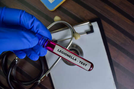 Uterine Fibroid write on sticky notes isolated on Wooden Table.の写真素材