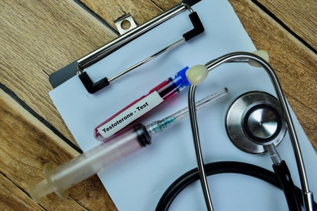 Concept of Testoterone - Test with blood sample. Healthcare or medical concept