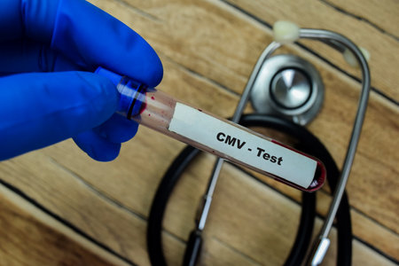 Concept of CMV - Test with blood sample. Healthcare or medical conceptの写真素材