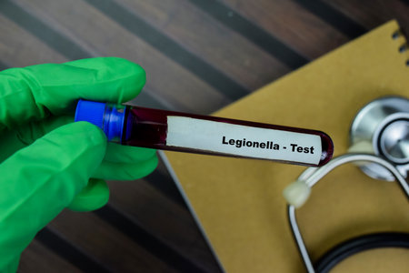 Concept of Legionella - Test with blood sample. Healthcare or medical conceptの写真素材