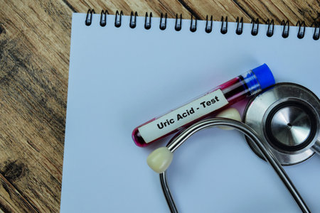 Concept of Uric Acid - Test with blood sample. Healthcare or medical conceptの写真素材