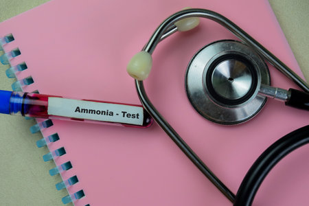Concept of Ammonia - Test with blood sample. Healthcare or medical conceptの写真素材