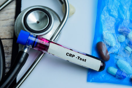 CRP - Test with blood sample on wooden background. Healthcare or medical conceptの写真素材