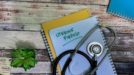 Concept of Uterine Fibroid write on book isolated on Wooden Table.の写真素材