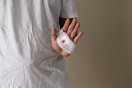 Doctor doing wound dressing care and bandaging patient's hand, hand surgery treatment.の写真素材