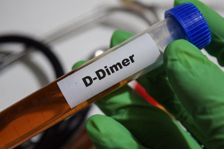 D-Dimer - Test with blood sample. Top view isolated on office desk. Healthcare or Medical conceptの写真素材