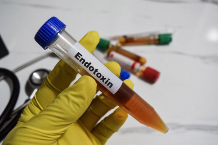 Endotoxin - Test with blood sample. Top view isolated on office desk. Healthcare or Medical conceptの写真素材