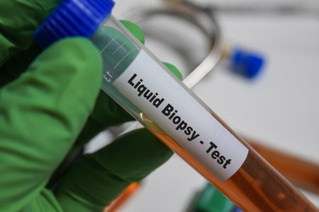 Liquid Biopsy - Test with blood sample. Top view isolated on office desk. Healthcare or Medical conceptの写真素材