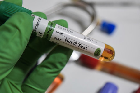 Her-2 - Test with blood sample. Top view isolated on office desk. Healthcare or Medical concept