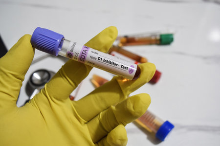 C1 Inhibitor - Test with blood sample. Top view isolated on office desk. Healthcare or Medical conceptの写真素材