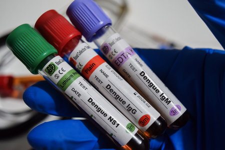 Dengue lGM, Dengue lGC, Dengue NS1 - Test with blood sample. Top view isolated on office desk. Healthcare or Medical conceptの写真素材