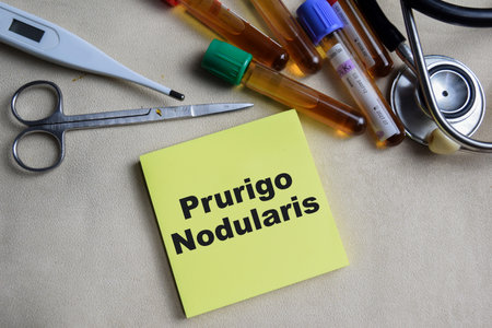 Concept of Prurigo Nodularis write on sticky notes isolated on Wooden Table.の写真素材