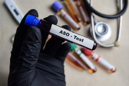 ASO - Test with blood sample in black gloved hands. healthcare or Medical conceptの写真素材