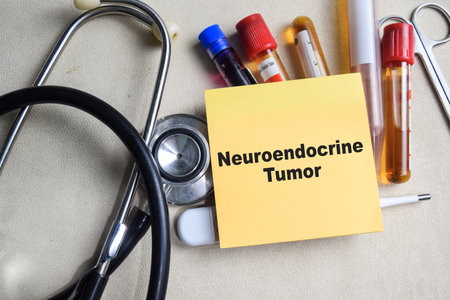 Concept of Neuroendocrine Tumor write on sticky notes isolated on Wooden Table. healthcare or Medical conceptの写真素材