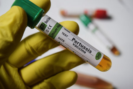 Pertussis vaccine - Test with blood sample in yellow gloved hands. healthcare or Medical conceptの写真素材