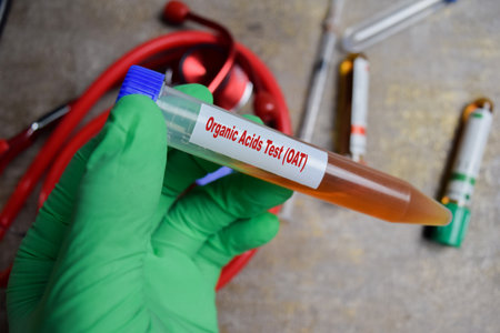 OAT - Organic Acids Test - Test with blood sample in green gloved hands. healthcare and pharmaceutical conceptの写真素材