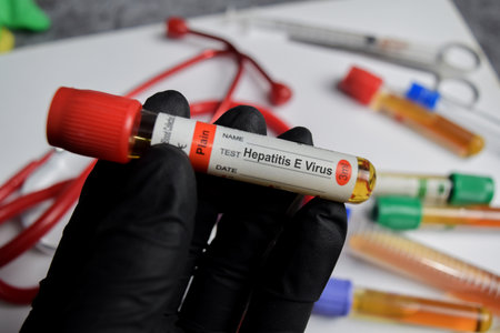 Hepatitis E virus vaccination drug in black gloved hands. Medical conceptの写真素材