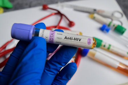 Anti-HIV vaccination drug in blue gloved hands. Medical conceptの写真素材