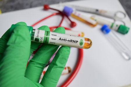 Anti-nRNP vaccination drug in green gloved hands. Medical conceptの写真素材