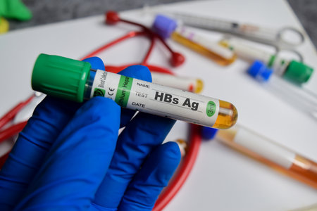 HBs Ag vaccination drug in blue gloved hands. Medical conceptの写真素材