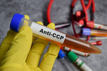 Anti-CCP vaccination drug in yellow gloved hands. Medical conceptの写真素材