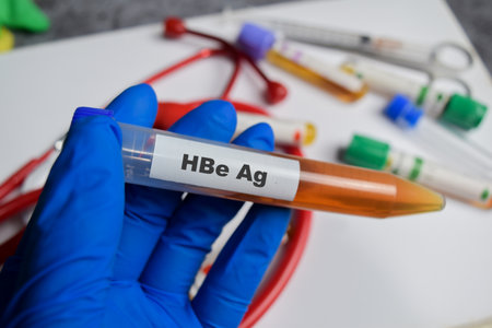 HBe Ag vaccination drug in blue gloved hands. Medical conceptの写真素材