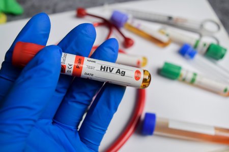 HIV Ag vaccination drug in blue gloved hands. Medical conceptの写真素材
